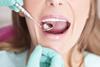 mouth dentist teeth